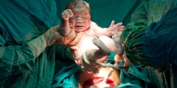 Küba’da sağlık devrimi sürüyor