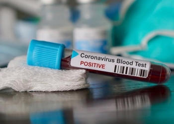 İmmün plazma tedavisi uygulanan Coronavirüs hastasından iyi haber