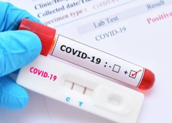 Türkiye PCR test zorunluluğunu uzattı