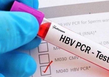 Türkiye hangi ülkelere PCR testi zorunluluğunu kaldırıyor?