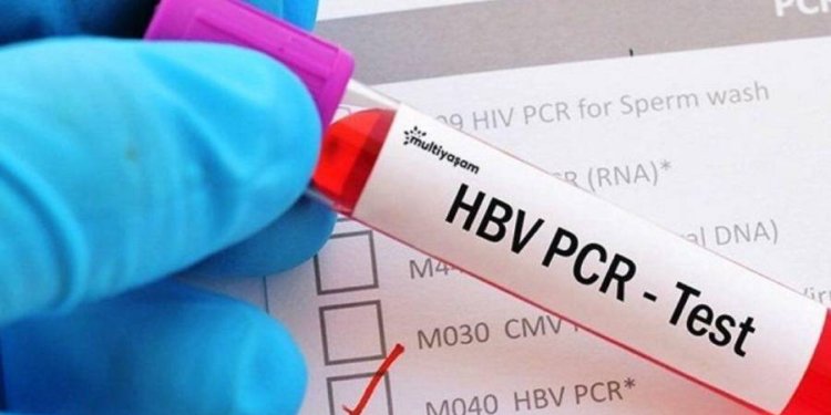 Türkiye hangi ülkelere PCR testi zorunluluğunu kaldırıyor