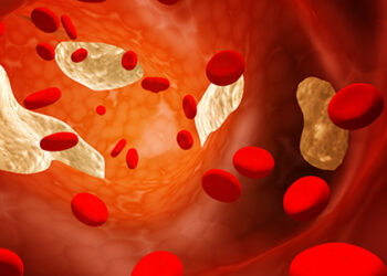 Kolesterol çok sık duyduğumuz tıbbi terimlerden biri... Peki, kolesterol nedir, tehlikeli midir? Yüksek kolesterole neler sebep olabilir?